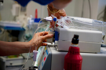 Cosmetic surgery: infiltration pump for liposuction.