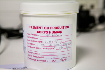 Femoral head in a biobank for the supply of human cellular and tissue.