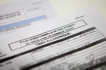 Sampling of tissues from a living donor.