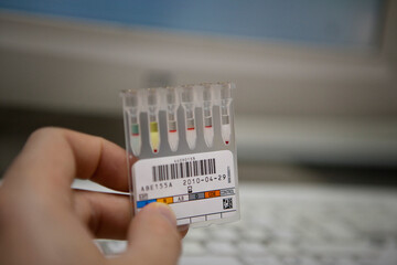 Equipment used for establishing blood groups in a hospital analysis.