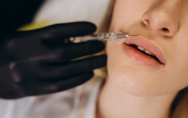 Close-up lips augmentation injections for attractive girl. Plastic surgeon does injection in lip in...