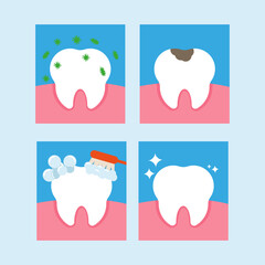 A set of cartoon teeth. Healthy and diseased tooth, caries.