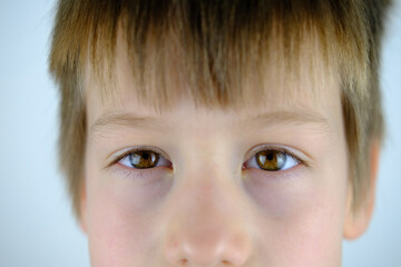close-up of part of the child's face, serious look of brown eyes, anxious face of boy 8-10 years old, childhood, problems of growing up children, psychological difficulties of loneliness