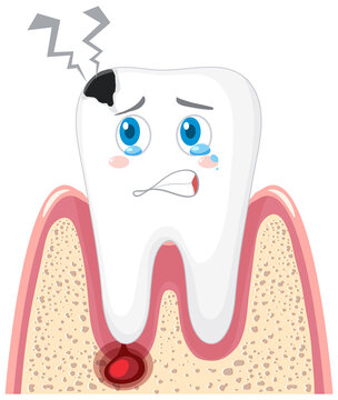 Caries and inflammation in the gums on a white background