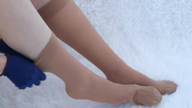 The girl puts on compression stockings. Special gloves for wearing compression stockings. The process of putting on medical stockings. Graduated compression stockings. Prevention and treatment of