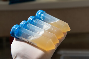 .centrifuge tube with a nutrient medium for the development of mycelium. Professional mycology, mushroom culture