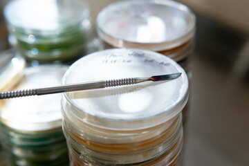 Selection and cultivation of mycelium. Mushroom cultivation around the world