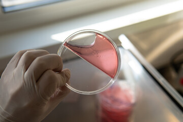 slants and petri dishes with agar for research. Mycology and cultivation of fungi.