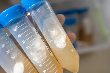 slants with agar for research. Mycology and cultivation of fungi.