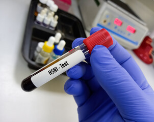 Blood sample for H1N1 influenza virus testing. A medical testing concept with laboratory background