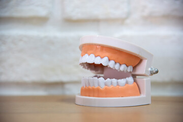 Model of teeth and gums.Dental concept