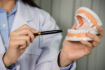 Doctor holding plastic jaw model for stomatology and explaining necessary procedure to patient at dentist office