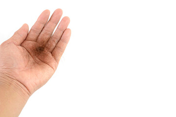 Brown hair, hair loss every day, serious problems and hair loss on a white background