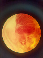 photo of faltworm tissue under the miccoscope