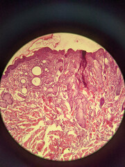 photo of human tissue under the miccoscope