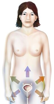 Illustration of bladder pathologies: cystitis cancer lithiasis .
