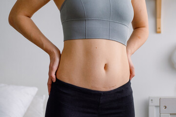 Close up of a belly with scar from c-section. Women’s health. A woman dressed up in sportswear...