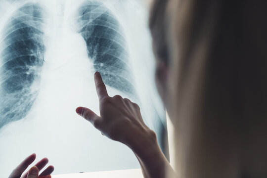 Finger touching chest x-ray skan. Professional analysis, healthcare concept. . High quality photo
