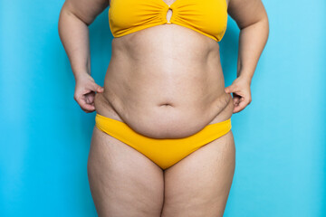 Pinch folds on woman sagging belly with hands closeup, big hips, obesity and cellulite. Naked overweight plus size girl on blue background in yellow underwear. Concept of dieting and lose weight.