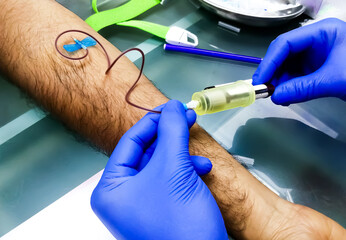 Phlebotomist collects blood sample in hospital for biochemical analysis. - obrazy, fototapety, plakaty