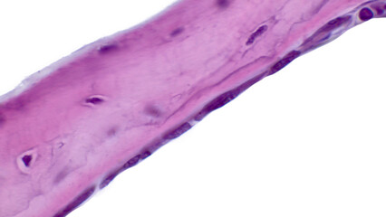 Light micrograph of intramembranous ossification. Trabeculae of bone are being formed by osteoblasts lining their surface.