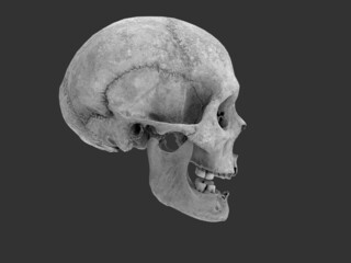 Human skull with missing teeth - side view