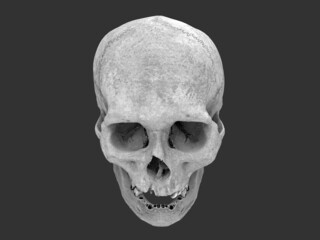 Human skull with missing teeth - top down view