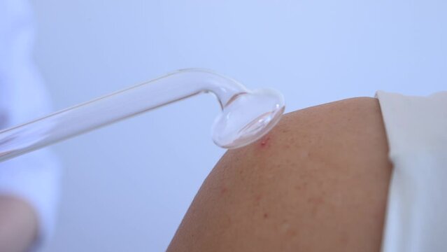 The doctor uses the darsonval apparatus against acne on the shoulder of a female patient.