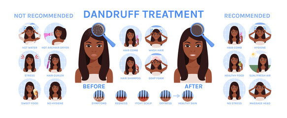 Dandruff on Female Head. Black Woman Treats Scalp from Dandruff. Set. Healthy Hair  and Happy Lady. Recommendations. Cartoon style. White background. Vector illustration for Medical and Beauty design.