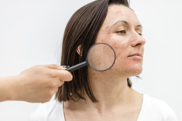 Close up photo of woman with dry skin with magnifying glass.