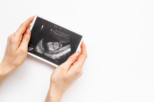 Pregnancy background with ultrasound picture of unborn baby