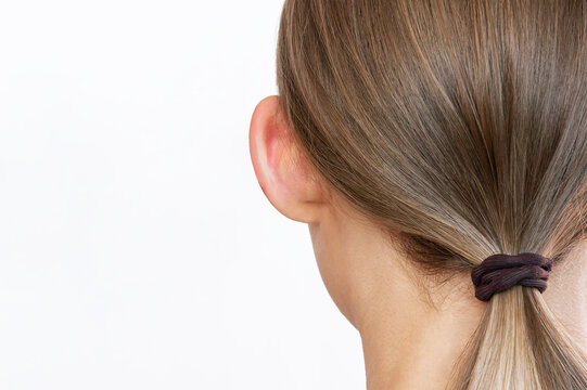 Cropped shot of woman's head with ears before and after otoplasty isolated on a white background. Before cosmetic plastic surgery of correction auricles and get rid of lop - eared. Otoplasty concept