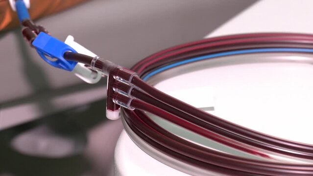 Apheresis machine to extract plasma and platelet from whole blood. Blood Purification Medical Procedure with Medical Device in Hospital