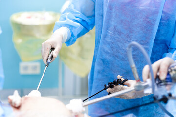 Surgeon's hands operate with instruments during laparoscopic surgery. Selective focus. Minimally invasive surgical treatment of proctological diseases.
