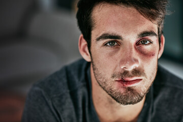 I may be beaten but I wont be broken. Cropped portrait of a beaten and bruised young man looking...