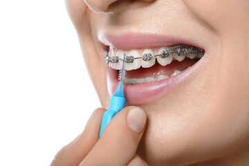 Woman brushing teeth with dental braces on white background, closeup
