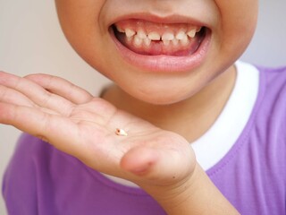 Little boy and broken teeth. closeup photo, blurred.