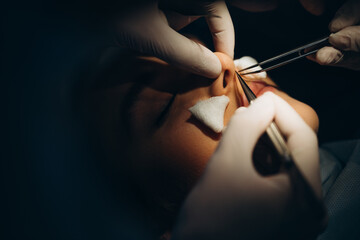 Surgeon and his assistant performing cosmetic surgery on nose in hospital operating room. Nose reshaping, augmentation. Rhinoplasty.