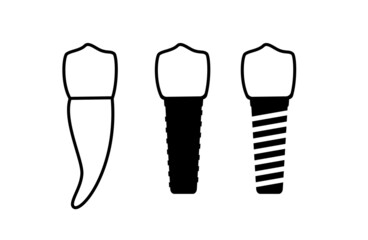 Dental implant procedure