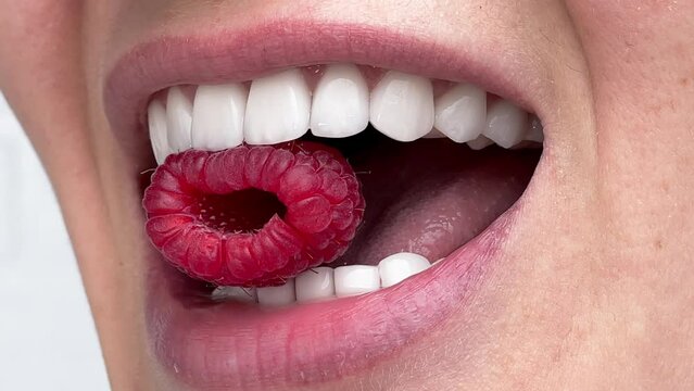 Perfect white teeth close up, female veneer smile with big red raspberry, dental care and stomatology.