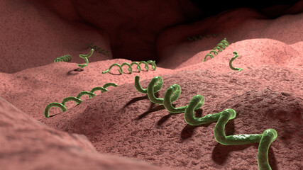 Syphilis infection, illustration