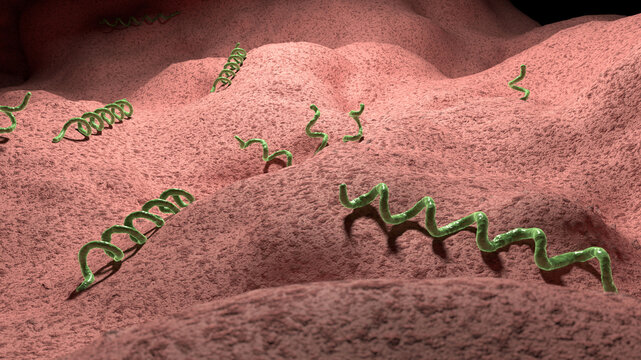 Syphilis infection, illustration