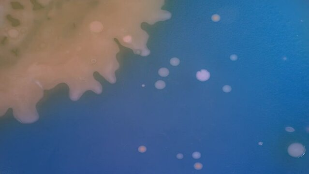 Timelapse of the growth of infectious microbes in a petri dish