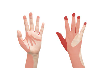 Good hygiene and hand washing concept. Front and back hands with red color that showing most often...