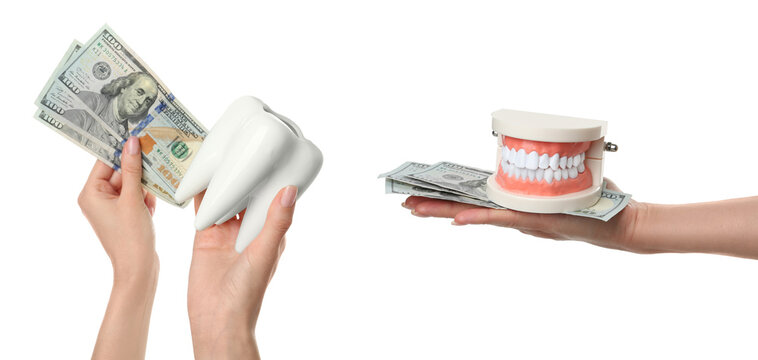 Collage with photos of women holding educational typodont, ceramic model of tooth and money on white background, closeup. Banner design