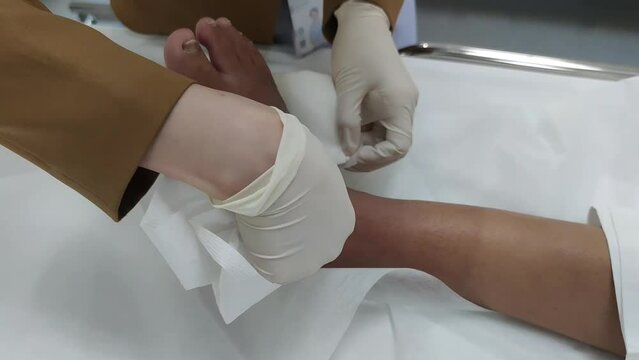 At HOSPITAL, THAILAND - Mar 2022. After the splint was cut, the nurse slowly unwrapped the bandage.