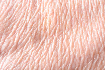 Texture of aging skin close up.