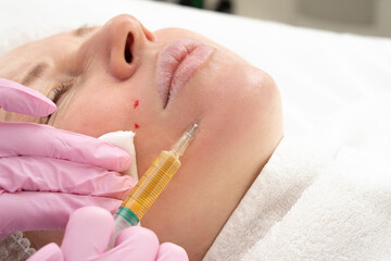 Cosmetologist makes prp-therapy blood plasma against wrinkles around the eyes and skin aging on the face of an adult woman Real procedure. The concept of cosmetology. - obrazy, fototapety, plakaty