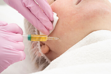 Cosmetologist makes prp-therapy blood plasma against wrinkles around the eyes and skin aging on the...