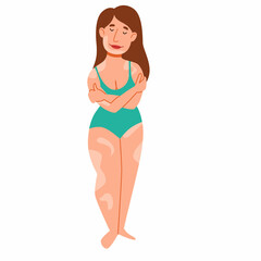 European plump woman with vitiligo. The girl hugs herself. The concept of body positivity, self-acceptance. skin disease vitiligo. Vector isolated illustration in a flat style on a white background.
